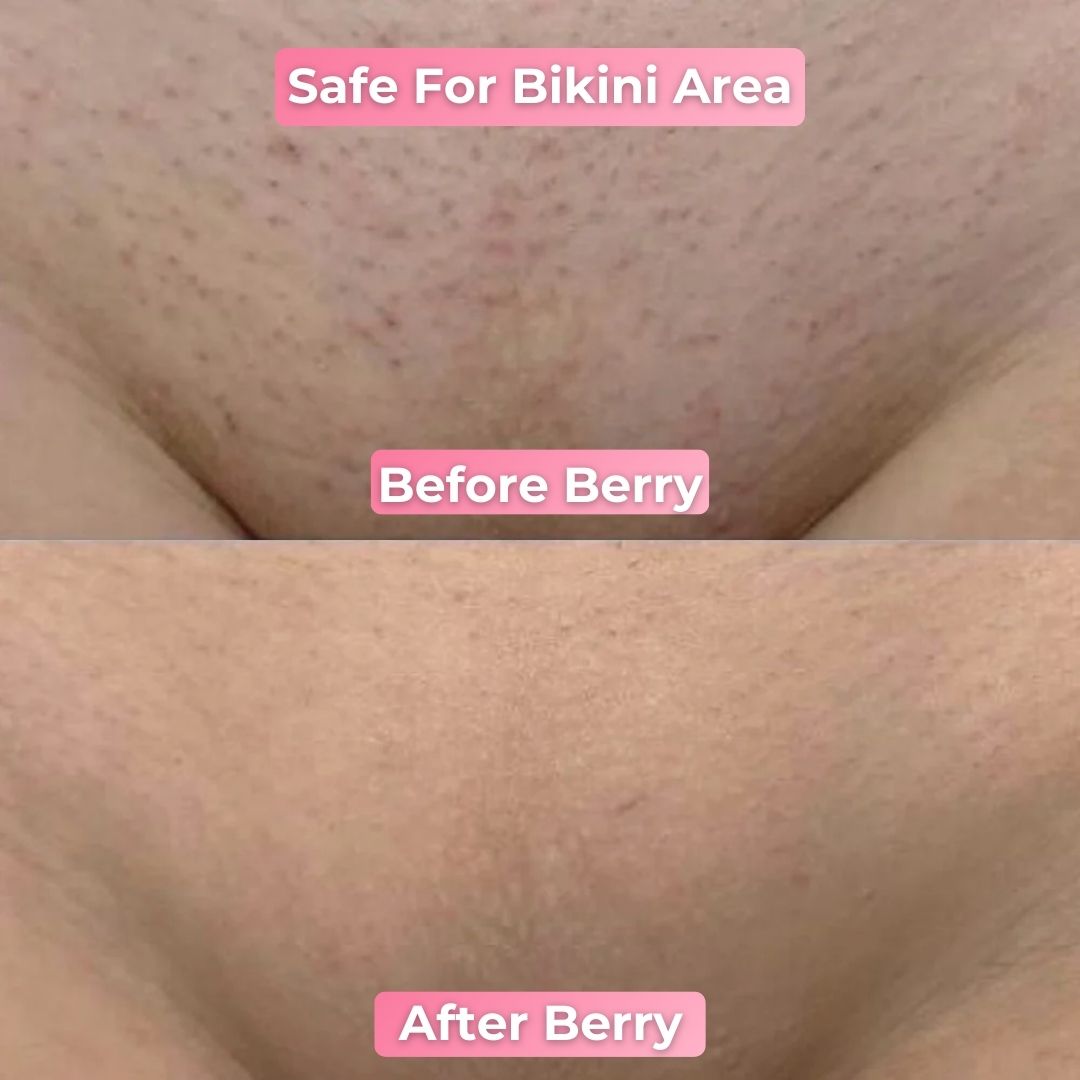 Berry Smooth Shaver | Pain Free Hair Removal