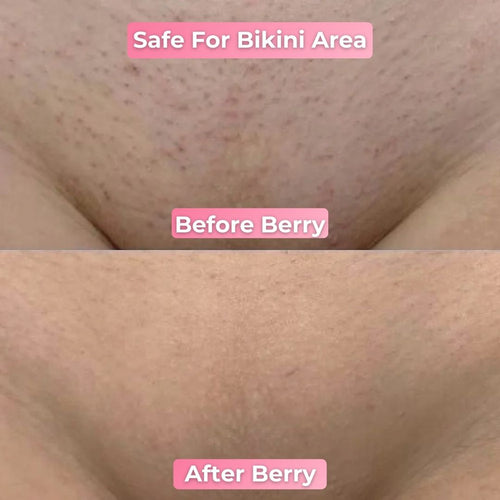 Berry Smooth Shaver | Pain Free Hair Removal