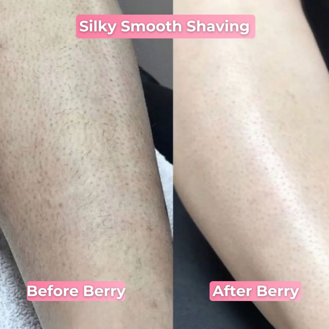 Berry Smooth Shaver | Pain Free Hair Removal